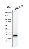 Anti-Melan A antibody [MLANA/1409R] used in Western Blot (WB). GTX34831