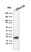 Anti-Melan A antibody [MLANA/1409R] used in Western Blot (WB). GTX34831