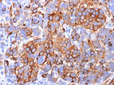 Anti-Melan A antibody [A103] used in IHC (Paraffin sections) (IHC-P). GTX34832