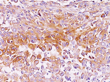 Anti-Melanoma gp100 antibody [SPM286] used in IHC (Paraffin sections) (IHC-P). GTX34836