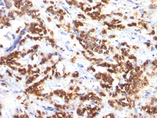 Anti-Milk Fat Globule 1 antibody [MFG-06] used in IHC (Paraffin sections) (IHC-P). GTX34839