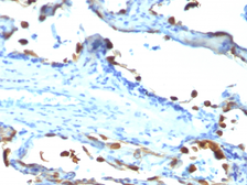 Anti-Milk Fat Globule 1 antibody [EDM45] used in IHC (Paraffin sections) (IHC-P). GTX34841