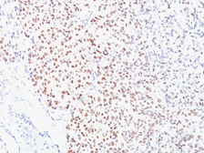 Anti-MITF antibody [D5] used in IHC (Paraffin sections) (IHC-P). GTX34842