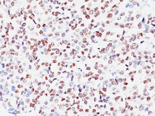 Anti-MITF antibody [SPM290] used in IHC (Paraffin sections) (IHC-P). GTX34843