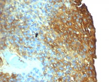 Anti-Moesin antibody [SPM562] used in IHC (Paraffin sections) (IHC-P). GTX34847