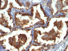 Anti-MUC1 antibody [MUC1/955] used in IHC (Paraffin sections) (IHC-P). GTX34852