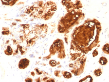 Anti-MUC1 antibody [rMUC1/960] used in IHC (Paraffin sections) (IHC-P). GTX34853
