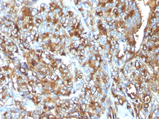 Anti-MUC1 antibody [MUC1/520] used in IHC (Paraffin sections) (IHC-P). GTX34855
