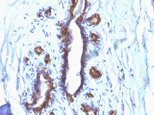 Anti-MUC1 antibody [SPM132] used in IHC (Paraffin sections) (IHC-P). GTX34856
