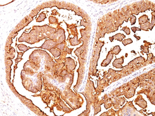 Anti-MUC1 antibody [E29] used in IHC (Paraffin sections) (IHC-P). GTX34857