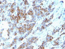 Anti-MUC1 antibody [SPM533] used in IHC (Paraffin sections) (IHC-P). GTX34858