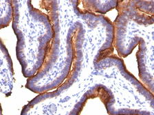 Anti-MUC1 antibody [MUC1/845] used in IHC (Paraffin sections) (IHC-P). GTX34859