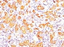 Anti-MUC1 antibody [GP1.4] used in IHC (Paraffin sections) (IHC-P). GTX34863
