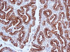 Anti-Mucin 5AC antibody [CLH2] used in IHC (Paraffin sections) (IHC-P). GTX34869