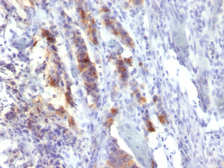 Anti-Mucin 5AC antibody [SPM488] used in IHC (Paraffin sections) (IHC-P). GTX34870