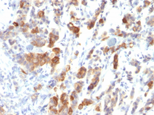 Anti-Mucin 5AC antibody [MUC5AC/917] used in IHC (Paraffin sections) (IHC-P). GTX34871