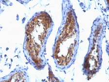 Anti-MVP/LRP antibody [SPM280] used in IHC (Paraffin sections) (IHC-P). GTX34877