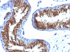 Anti-MVP/LRP antibody [1032] used in IHC (Paraffin sections) (IHC-P). GTX34878