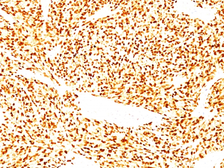 Anti-MyoD1 antibody [SPM427] used in IHC (Paraffin sections) (IHC-P). GTX34882