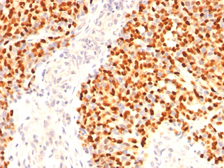 Anti-Myogenin antibody [F5D] used in IHC (Paraffin sections) (IHC-P). GTX34885