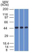 Anti-Napsin A antibody [NAPSA/1238] used in Western Blot (WB). GTX34887