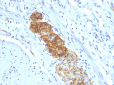 Anti-NCAM antibody [NCAM1/784] used in IHC (Paraffin sections) (IHC-P). GTX34893