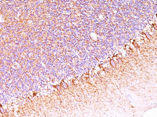 Anti-NF-H antibody [SPM563] used in IHC (Paraffin sections) (IHC-P). GTX34898