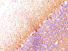 Anti-NF-L antibody [SPM204] used in IHC (Paraffin sections) (IHC-P). GTX34903