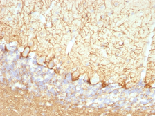 Anti-NF-L antibody [NFL/736] used in IHC (Paraffin sections) (IHC-P). GTX34904