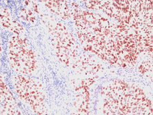 Anti-NKX2.1 antibody [SPM150] used in IHC (Paraffin sections) (IHC-P). GTX34905