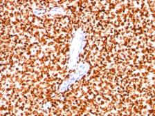Anti-Nkx2.2 antibody [SPM564] used in IHC (Paraffin sections) (IHC-P). GTX34909