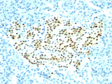 Anti-Nkx2.2 antibody [SPM564] used in IHC (Paraffin sections) (IHC-P). GTX34909