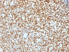 Anti-Nkx2.2 antibody [NX2/1422R] used in IHC (Paraffin sections) (IHC-P). GTX34913