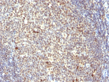 Anti-NuMA antibody [SPM300] used in IHC (Paraffin sections) (IHC-P). GTX34918