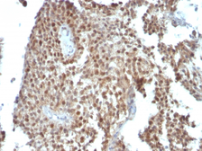 Anti-p21 Cip1 antibody [SPM306] used in IHC (Paraffin sections) (IHC-P). GTX34923