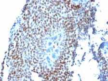 Anti-p21 Cip1 antibody [CIP1/823] used in IHC (Paraffin sections) (IHC-P). GTX34924