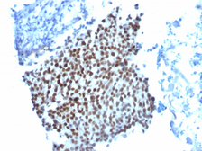 Anti-p21 Cip1 antibody [WA-1] used in IHC (Paraffin sections) (IHC-P). GTX34926