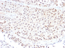 Anti-p21 Cip1 antibody [DCS-60.2] used in IHC (Paraffin sections) (IHC-P). GTX34927