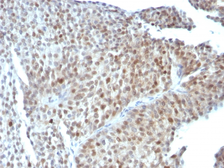 Anti-p53 antibody [SPM589] used in IHC (Paraffin sections) (IHC-P). GTX34932