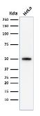 Anti-p53 antibody [SPM590] used in Western Blot (WB). GTX34933