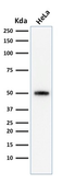 Anti-p53 antibody [SPM590] used in Western Blot (WB). GTX34933