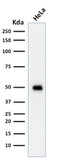 Anti-p53 antibody [TRP/817] used in Western Blot (WB). GTX34935