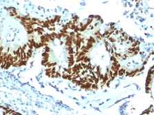 Anti-p53 antibody [TP53/1799R] used in IHC (Paraffin sections) (IHC-P). GTX34936