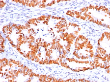 Anti-p53 antibody [BP53-12] used in IHC (Paraffin sections) (IHC-P). GTX34937