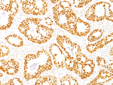 Anti-p53 antibody [DO-7] used in IHC (Paraffin sections) (IHC-P). GTX34938