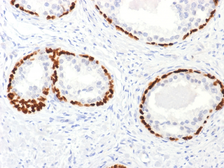 Anti-p63 antibody used in IHC (Paraffin sections) (IHC-P). GTX34943