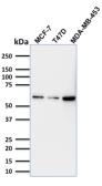 Anti-p63 antibody [TP63/1786] used in Western Blot (WB). GTX34944
