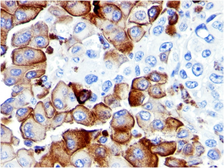 Anti-p75 NGF Receptor / CD271 antibody [NGFR5] used in IHC (Paraffin sections) (IHC-P). GTX34945