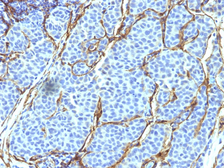 Anti-p75 NGF Receptor / CD271 antibody [SPM299] used in IHC (Paraffin sections) (IHC-P). GTX34946