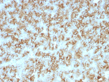 Anti-Parathyroid Hormone antibody [PTH/911] used in IHC (Paraffin sections) (IHC-P). GTX34949
